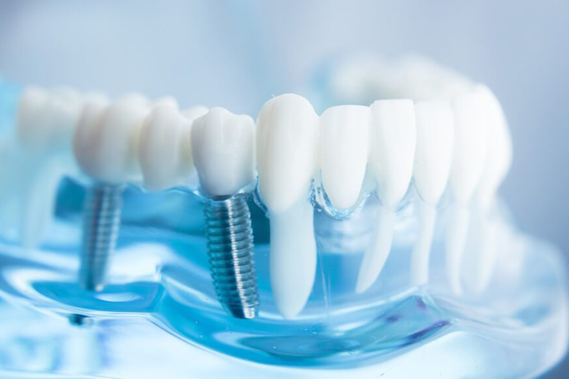 chirurgia